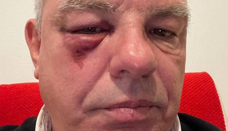 , Deux hommes suspect&eacute;s de l&rsquo;agression du maire du P&eacute;age-de-Roussillon &agrave; Avignon interpell&eacute;s