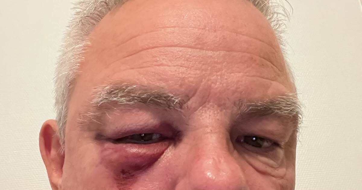 , Avignon Agression du maire du P&eacute;age-de-Roussillon : les deux suspects jug&eacute;s en comparution imm&eacute;diate