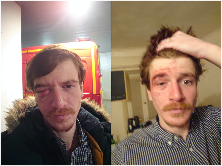 https://www.protection-des-elus.cdcl.fr/wp-content/uploads/2024/04/a-marseille-un-policier-eborgne-un-manifestant-bouscule-un-elu-et-profere-des-insultes-homophobes.png