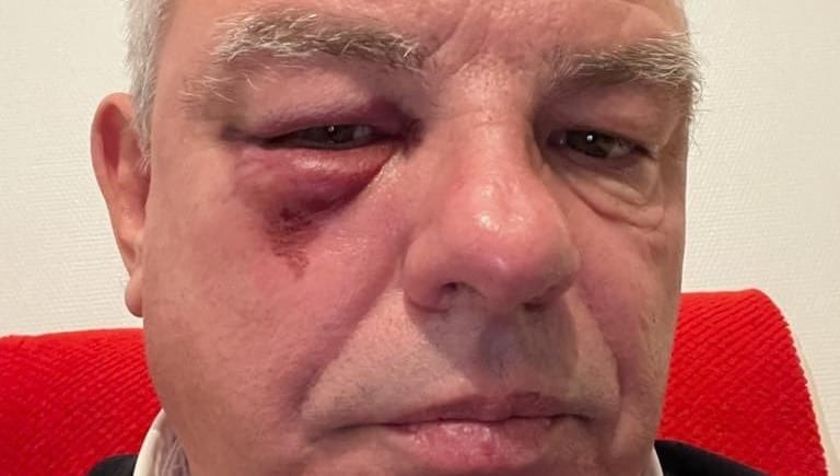 , Justice : proc&egrave;s renvoy&eacute; pour les militants identitaires accus&eacute;s d&rsquo;avoir agress&eacute; le maire PCF de P&eacute;age-de-Roussillon