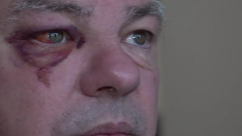 Andr&eacute; Mondange, maire de P&eacute;age-de-Roussillon, juste apr&egrave;s son agression