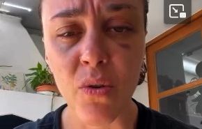 , Montpellier : Apr&egrave;s une agression lesbophobe, pr&eacute;fet et maire s&rsquo;interrogent sur le traitement de la plainte par la police