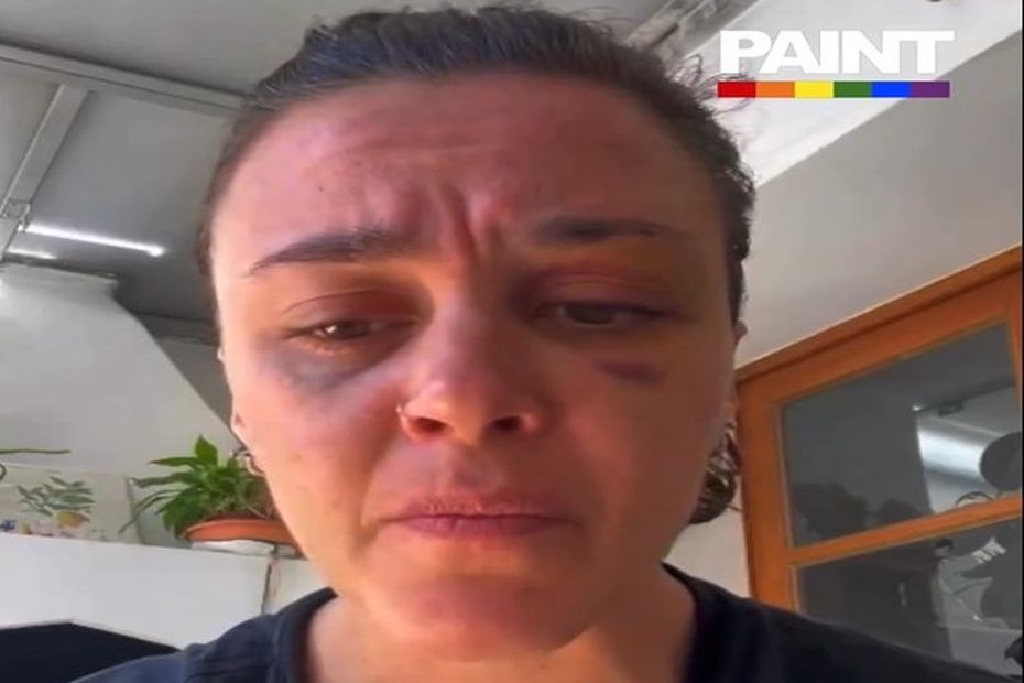 , VIDEO. Agression lesbophobe : &laquo;&nbsp;Si tu veux &ecirc;tre un homme, bats-toi comme un homme&nbsp;&raquo;, une femme frapp&eacute;e par plusieurs personnes