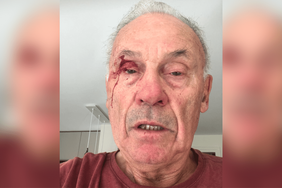 , &laquo;&nbsp;Il m&rsquo;a donn&eacute; un coup de poing&nbsp;&raquo; : un &eacute;lu agress&eacute; alors qu&rsquo;il collait des affiches pour la campagne d&rsquo;Olivier V&eacute;ran, un homme en garde &agrave; vue