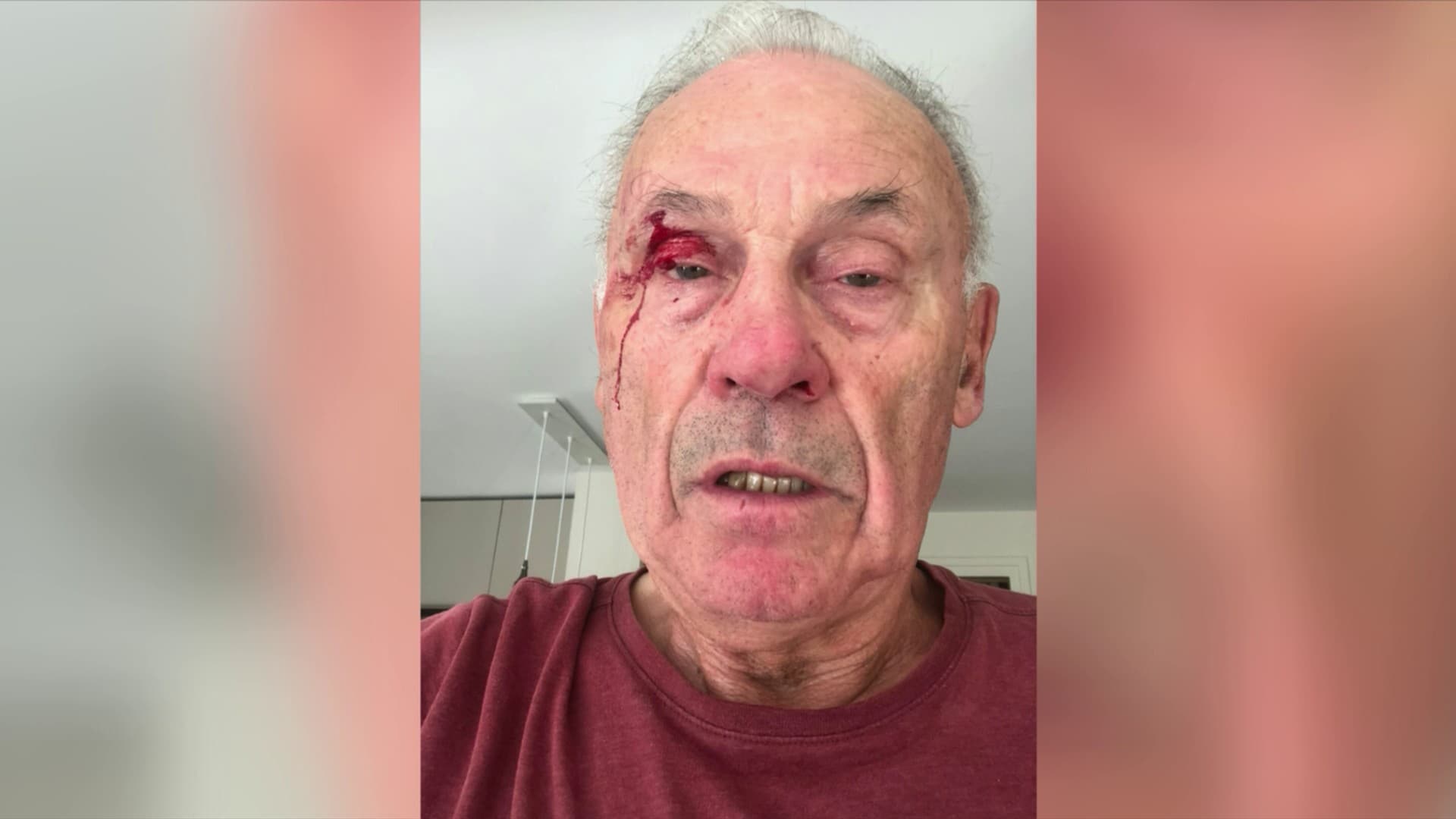 , Le suspect de l&rsquo;agression d&rsquo;un &eacute;lu local is&eacute;rois &laquo;&nbsp;en cours de d&eacute;ferrement&nbsp;&raquo; et &laquo;&nbsp;pr&eacute;tend avoir &eacute;t&eacute; frapp&eacute; en premier&nbsp;&raquo;