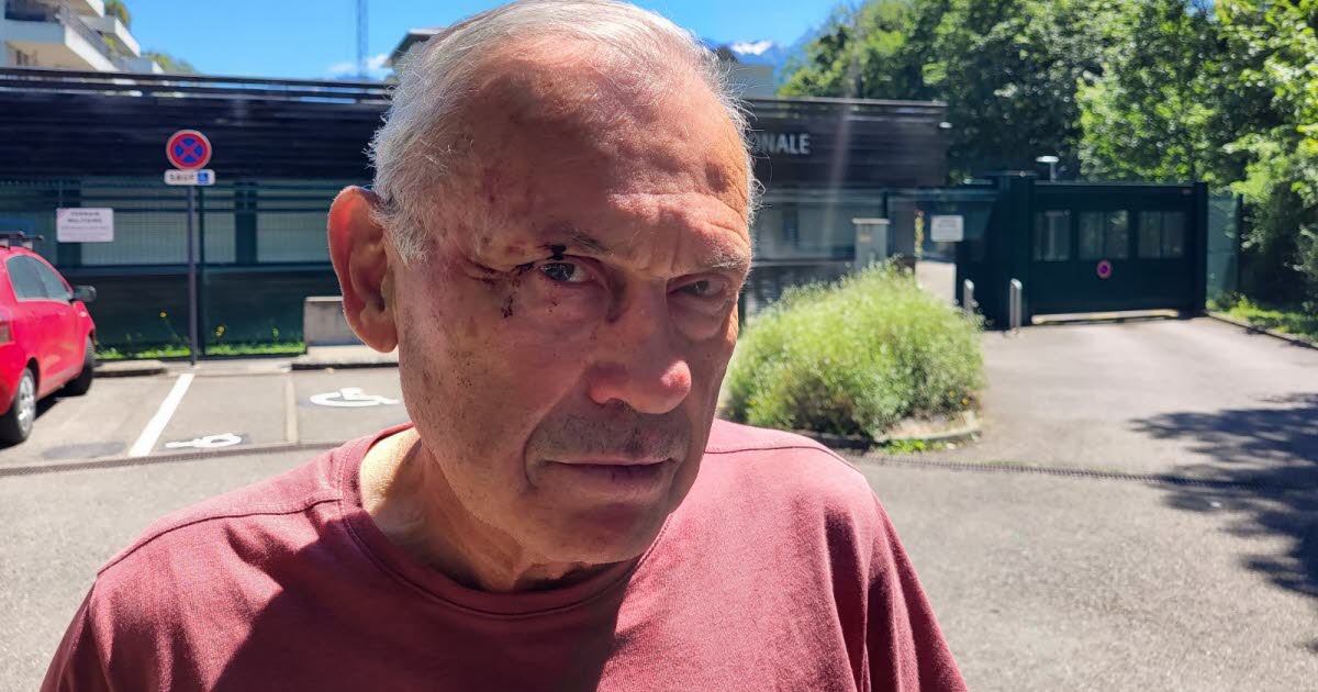 , L&eacute;gislatives en Is&egrave;re Un &eacute;lu re&ccedil;oit un coup de poing lors d&rsquo;un collage