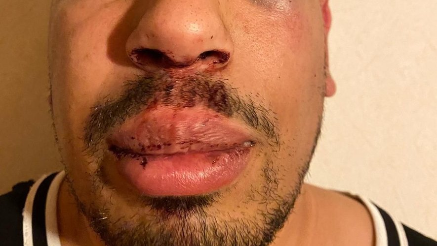 , Soup&ccedil;on d&rsquo;agression dans un club de rugby amateur : &laquo;&nbsp;Il n&rsquo;y a pas de raciste chez nous !&nbsp;&raquo;&hellip; le pr&eacute;sident contre-attaque