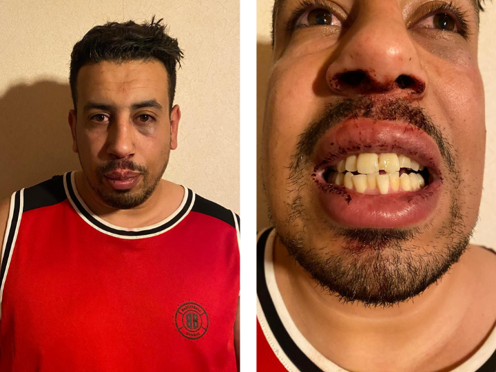 https://www.protection-des-elus.cdcl.fr/wp-content/uploads/2024/11/huissiers-insultes-et-dents-cassees-des-habitants-dun-village-du-lot-et-garonne-denoncent-du-harcelement-raciste.png
