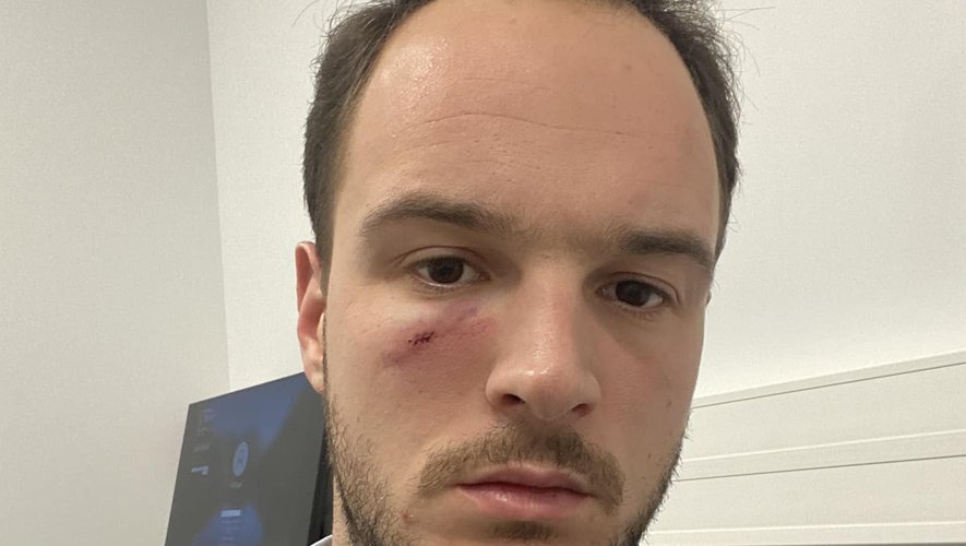 , &laquo;&nbsp;Je n&rsquo;imaginais pas qu&rsquo;il descendrait de son v&eacute;hicule pour me casser la figure&nbsp;&raquo; : un &eacute;lu est agress&eacute; par un chauffard en pleine rue