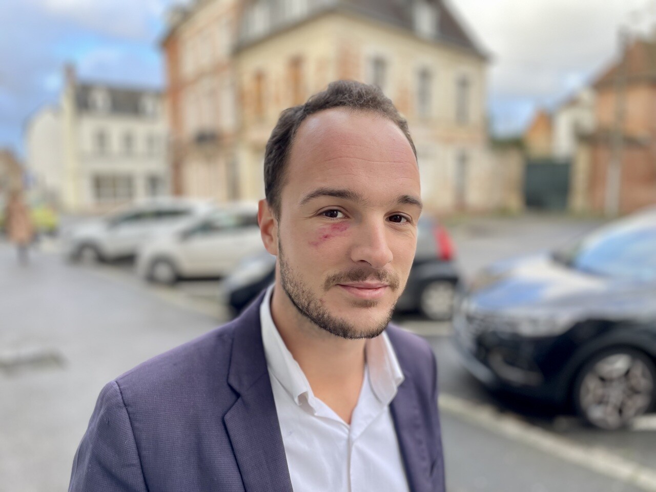 , L&rsquo;&eacute;lu d&rsquo;Abbeville Angelo Tonolli frapp&eacute; au visage en plein centre-ville par un automobiliste