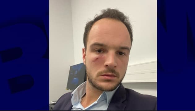 , Somme: un conseiller agress&eacute; par un chauffard, vague de soutien du monde politique local