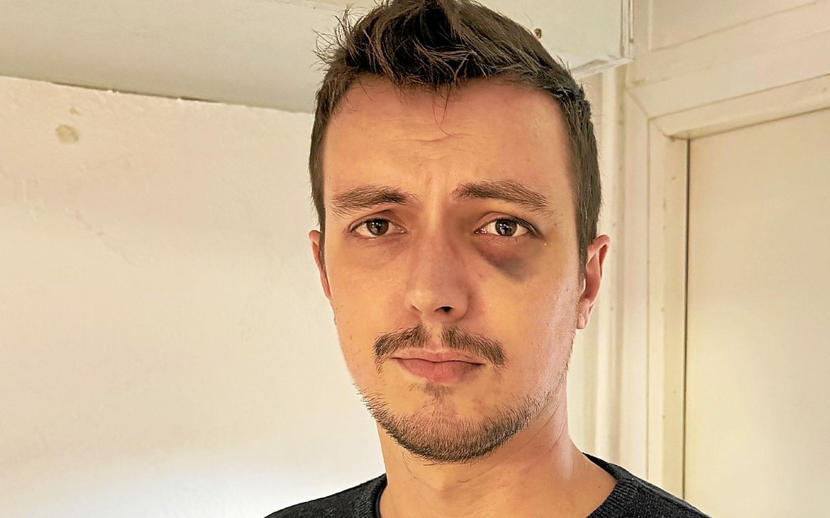 , Il fait un salut nazi devant un bar : un &eacute;lu breton s&rsquo;interpose et se fait agresser