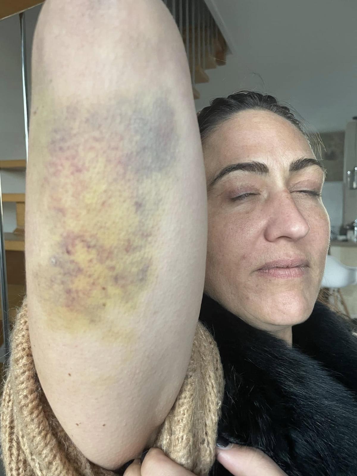 , Violences conjugales: l&rsquo;&eacute;lue angoumoisine Sandra Ros l&egrave;ve le voile sur sa descente aux enfers