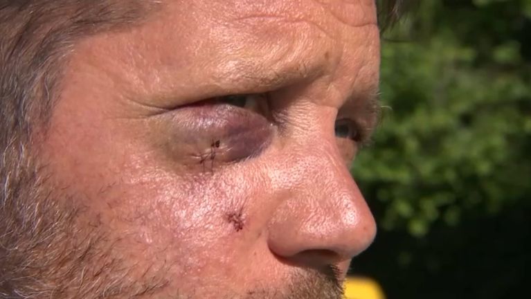 Anthony Rolland, &eacute;lu municipal &agrave; Gauriaguet (Gironde), a &eacute;t&eacute; violemment agress&eacute; le samedi 3 mai au soir.