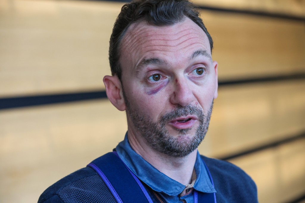 Blessé au visage et à l’épaule, le maire de Waziers a raconté l’agression subie lors d’un pot organisé après les commémorations du 8-Mai. Photo © Francois Greuez/SIPA
