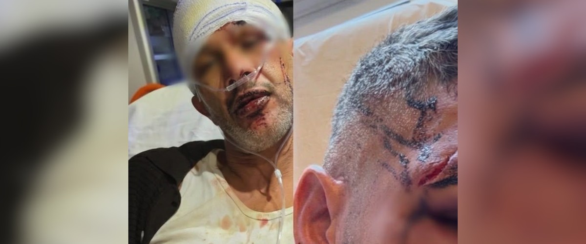 , « Ils l’ont tabassé » : un homme roué de coups lors de la fête d’un village de l’Hérault, le maire de la commune visé par une plainte