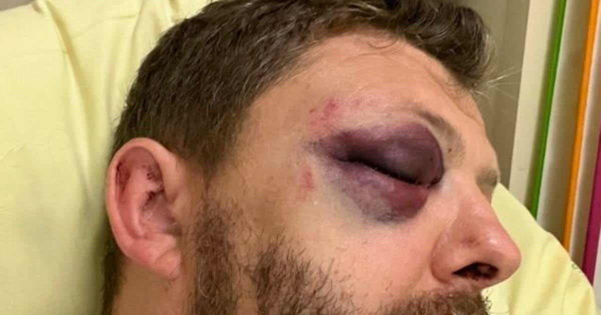 , Paris Un policier victime d&rsquo;une violente agression homophobe dans le quartier du Marais