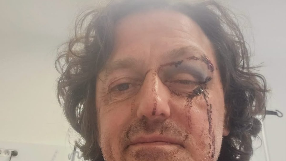 , Un maire a-t-il été « violemment pris à partie et frappé par des individus » ? L’élu apparaît blessé sur un post Facebook de la mairie avant que ce dernier ne soit retiré